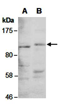 HDAC5 (N) Antibody, Rabbit Polyclonal