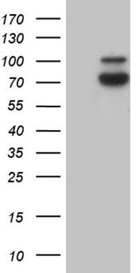 HDAC8 Antibody