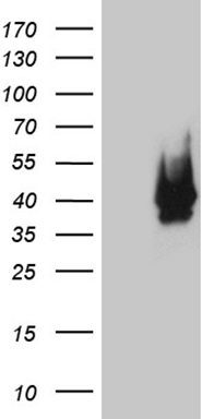 HDAC8 Antibody