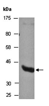 HDAC8 (C) Antibody, Rabbit Polyclonal