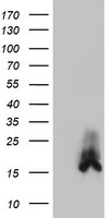 HDHD2 Antibody