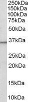 HSD11B1/HDL Antibody