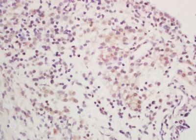HDLBP Rabbit Polyclonal Antibody
