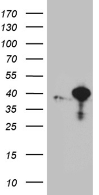 NEDD9 Antibody