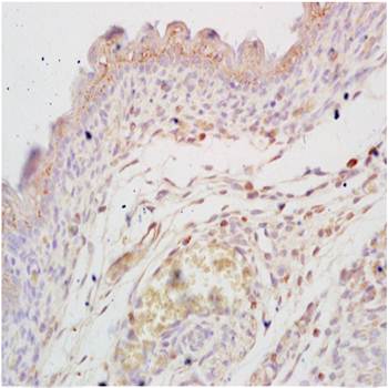 HSPG2/Heparan Sulfate Proteoglycan 2 Rabbit Polyclonal Antibody