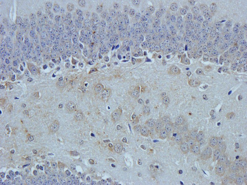 HEPCIDIN antibody