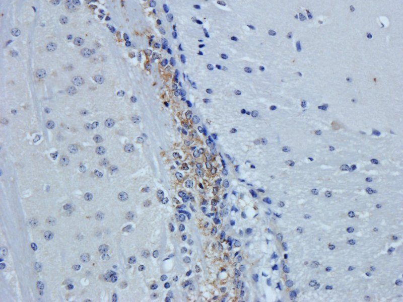 HEPCIDIN antibody