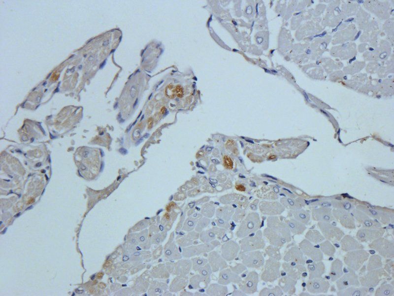 HEPCIDIN antibody