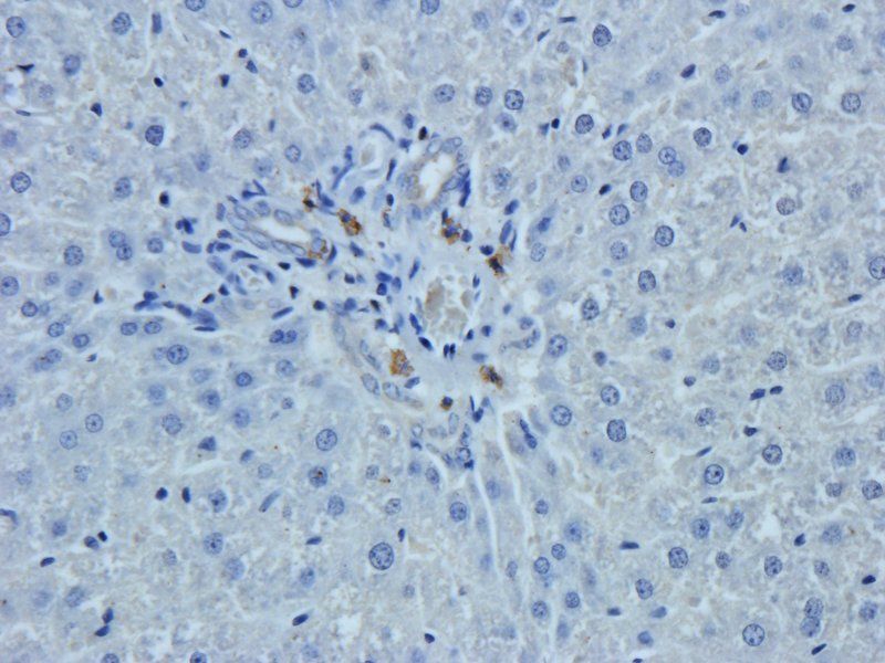 HEPCIDIN antibody