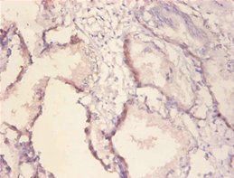 ERBB2 Antibody