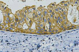 ERBB2 Antibody
