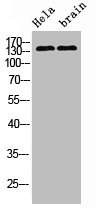 ERBB2 Antibody