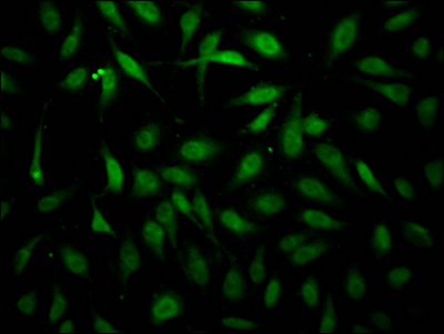 ERBB2 Antibody
