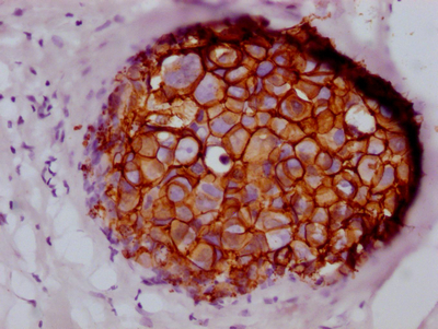 ERBB2 Antibody
