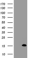 ERBB2 Antibody