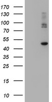 ERBB2 Antibody