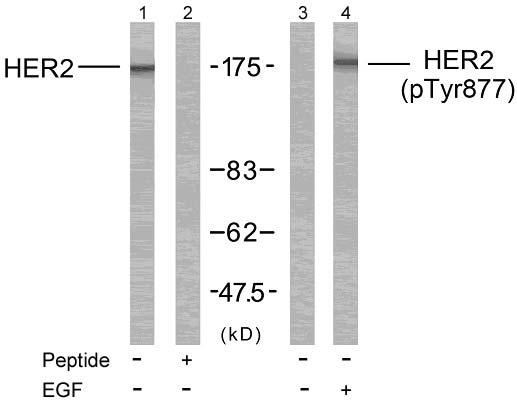 HER2 (Phospho-Tyr877) Antibody