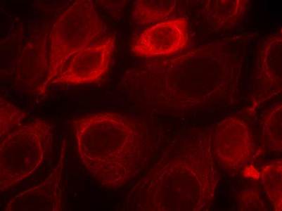 Her3/ErbB3 (phospho-Tyr1328) Antibody