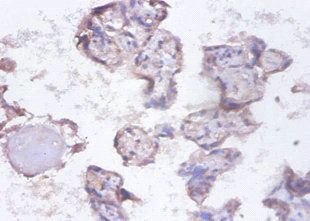 SYNCRIP Antibody