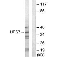 HEXIM1 Antibody