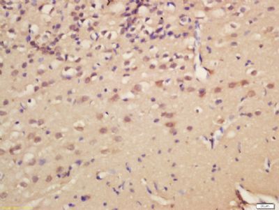 HEY1 Rabbit Polyclonal Antibody