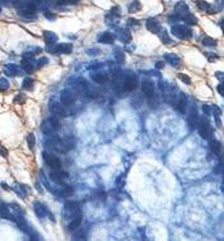 HGD Rabbit Polyclonal Antibody