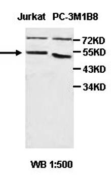 HGD Rabbit Polyclonal Antibody