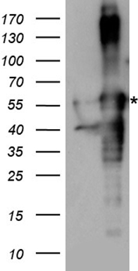HIC5 Antibody