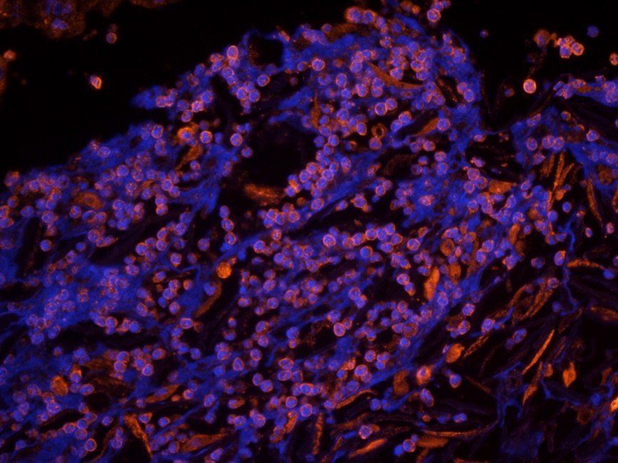 HIG2 Rabbit Polyclonal Antibody