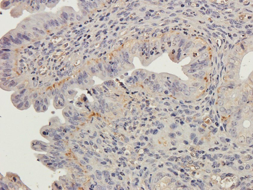 HIG2 Rabbit Polyclonal Antibody