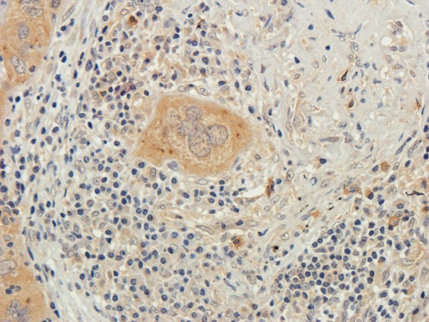 HIG2 Rabbit Polyclonal Antibody