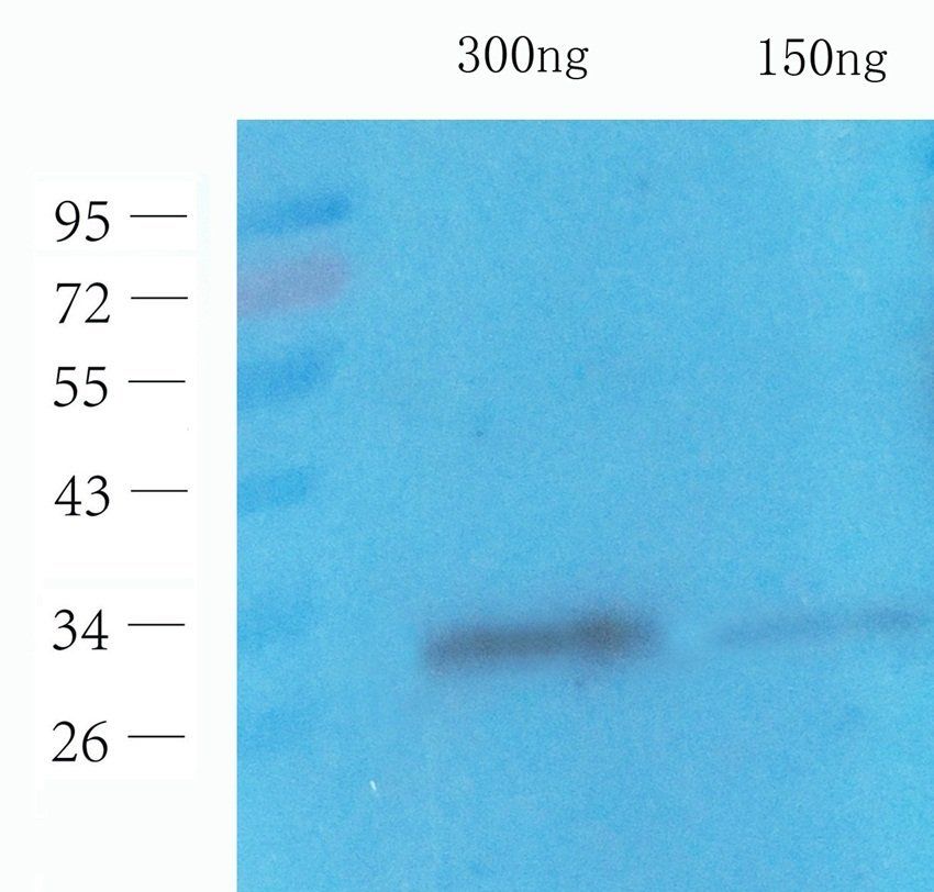 His Tag Rabbit Polyclonal Antibody