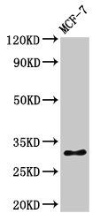 HIST1H1B Antibody