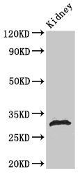 HIST1H1B Antibody