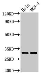 HIST1H1B Antibody