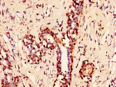 HIST1H1C Antibody