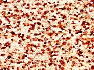 HIST1H1C Antibody