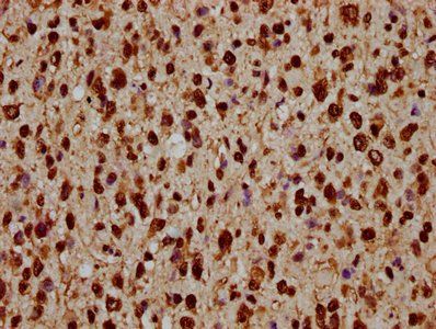 HIST1H1C Antibody