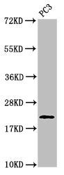 HIST1H1D Antibody