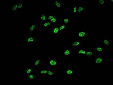 HIST1H1E Antibody