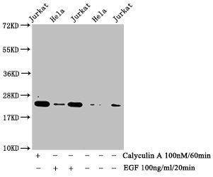 HIST1H1E Antibody