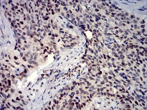 HIST2H3C(27Ac) Antibody