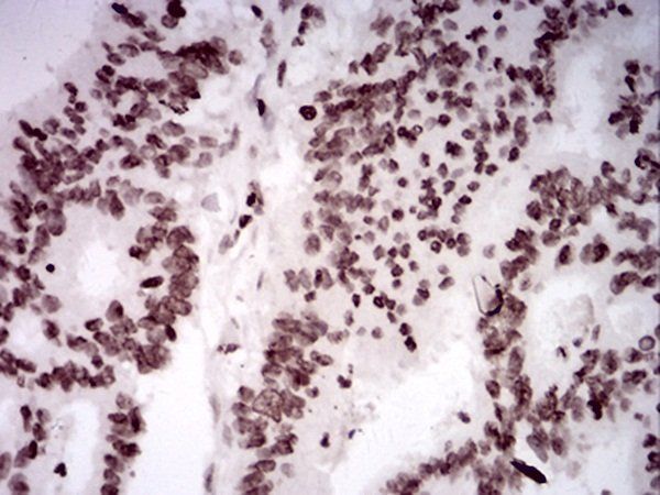 HIST2H4A(20Me) Antibody