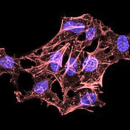 HIST2H4A(20Me) Antibody