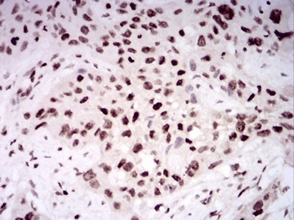 HIST2H4A(20Me) Antibody