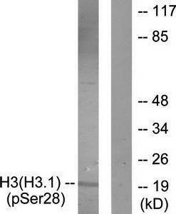 Histone H3 (Phospho-Ser28) Antibody