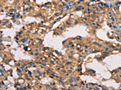HK3 Antibody