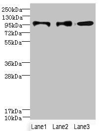 HKDC1 Antibody