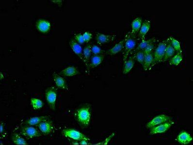HLA-B Antibody
