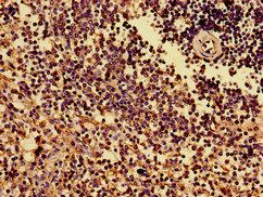 HLA-B Antibody